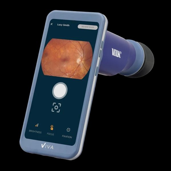 Viva Non-Mydriatic Handheld Retinal Camera