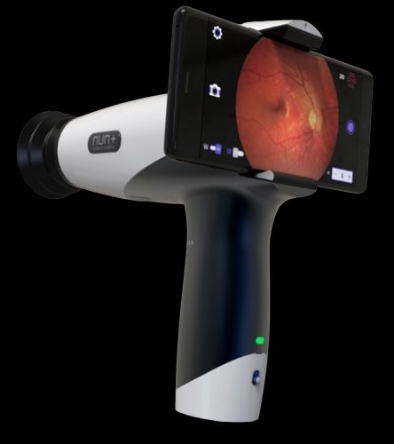 Ophthalmoscope (WFE-02S)