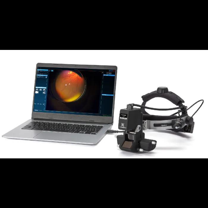 Ophtalmoscope indirect Vantage Plus LED