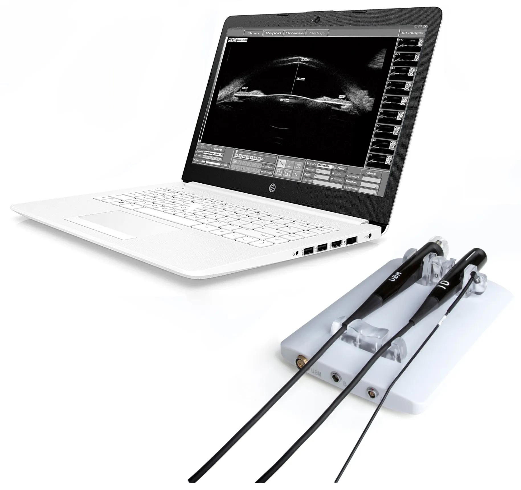 SUOER SW-21 Delta – Scanner Ultrasons (A/B/P/UBM)