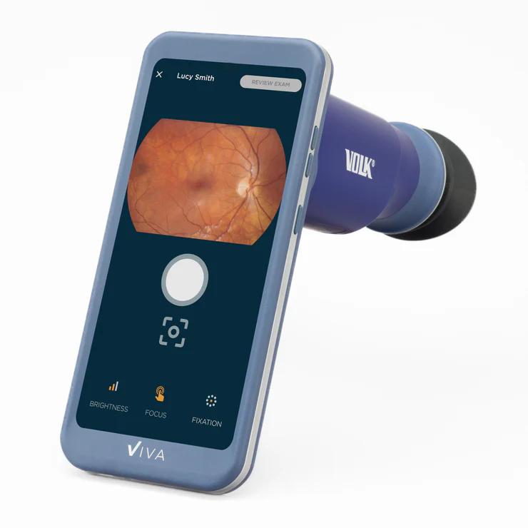 Le Volk Viva Non-Mydriatic Handheld Retinal Camera
