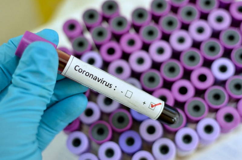 coronavirus-660x4002x
